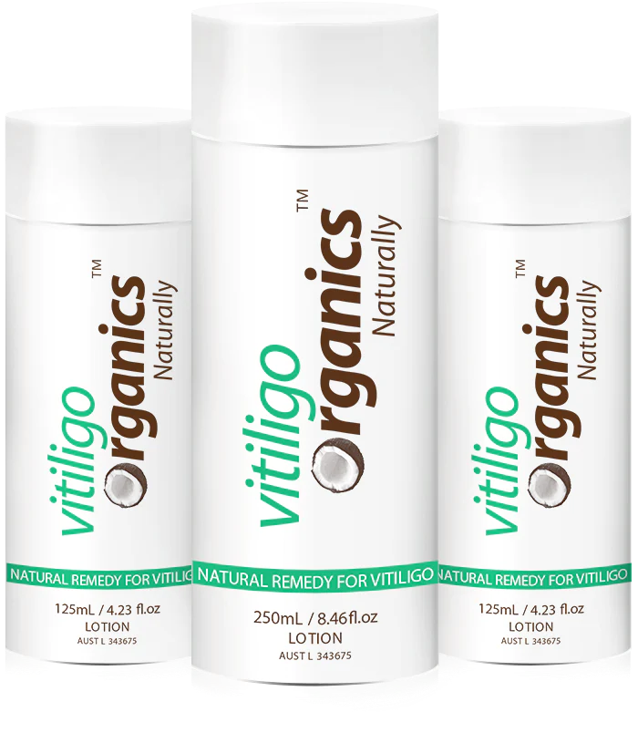 Vitiligo Organics