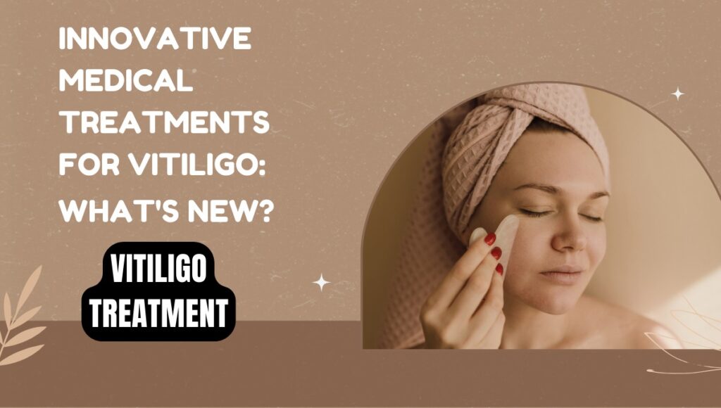 Vitiligo Treatment