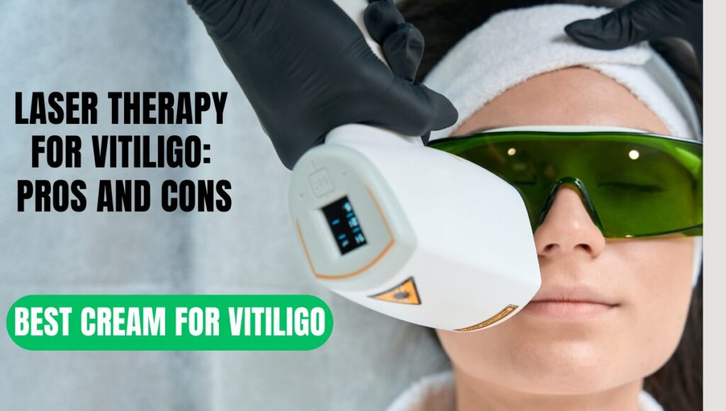 Vitiligo Treatment