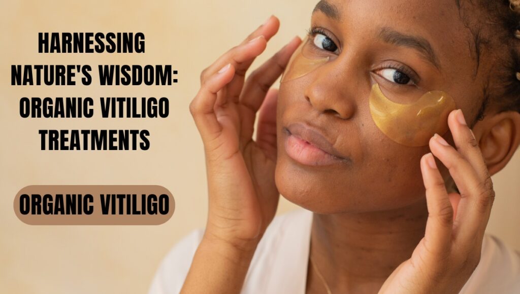 Organic Vitiligo