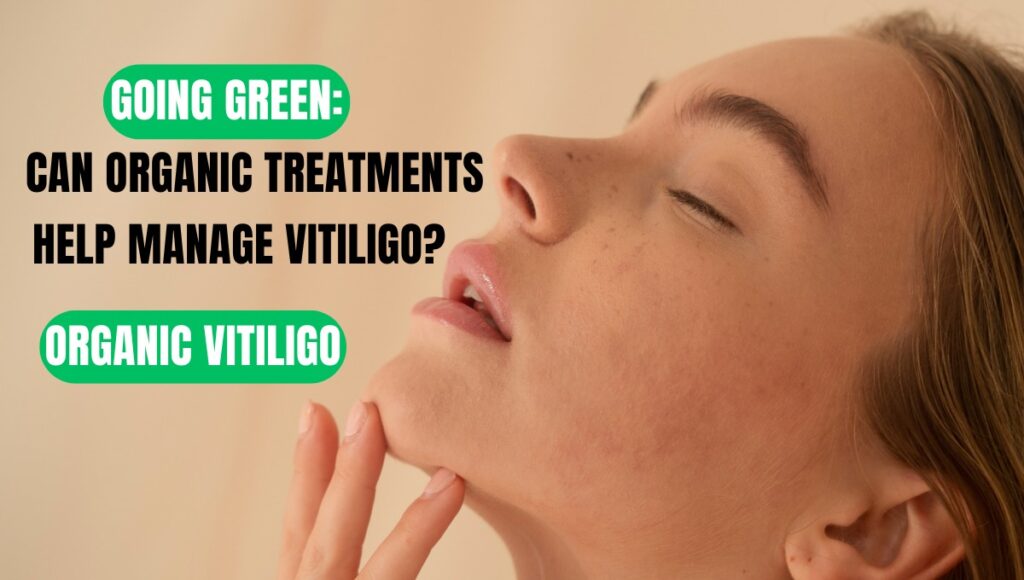 Vitiligo Organics