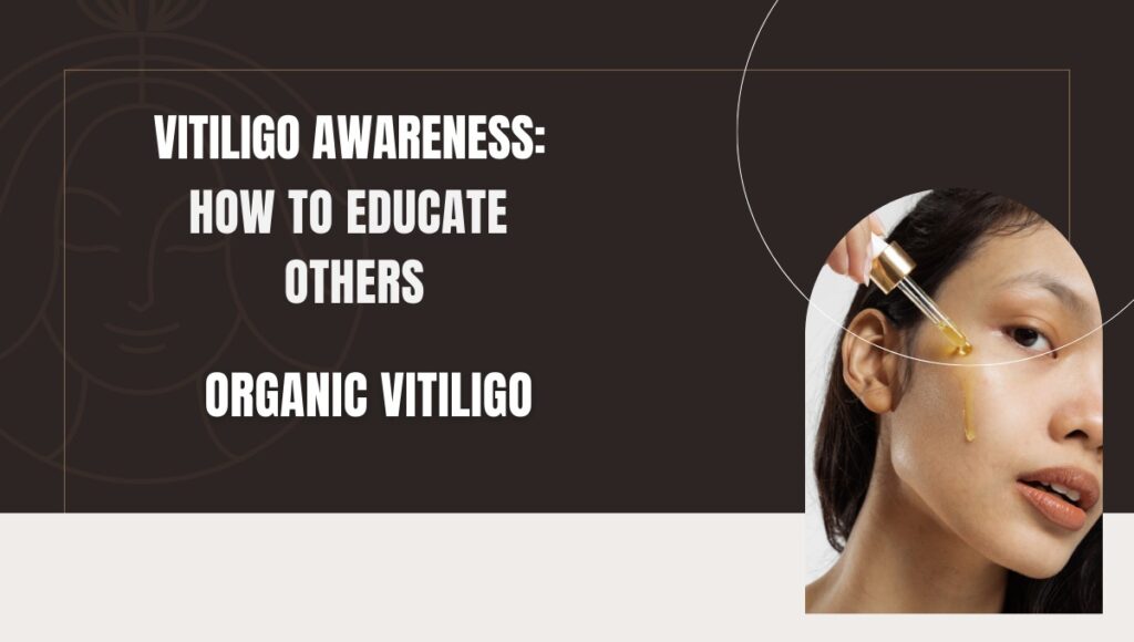 organic vitiligo