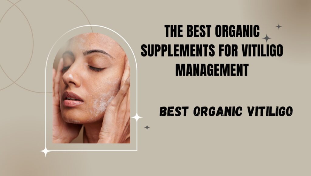 best organic vitiligo supplements